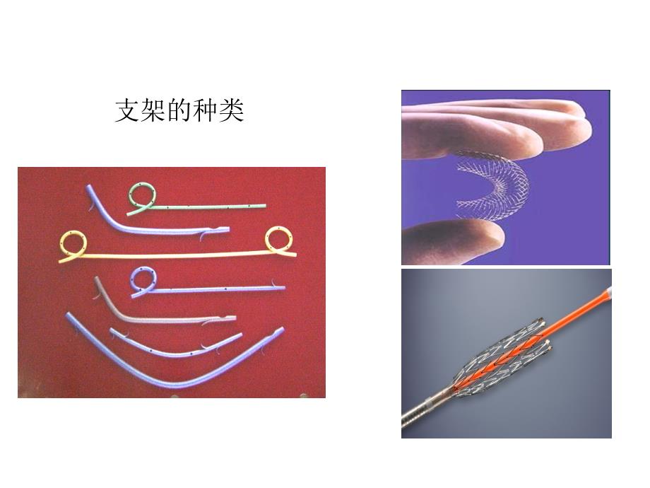 ercp下胆道胰管支架置入ppt课件_第3页